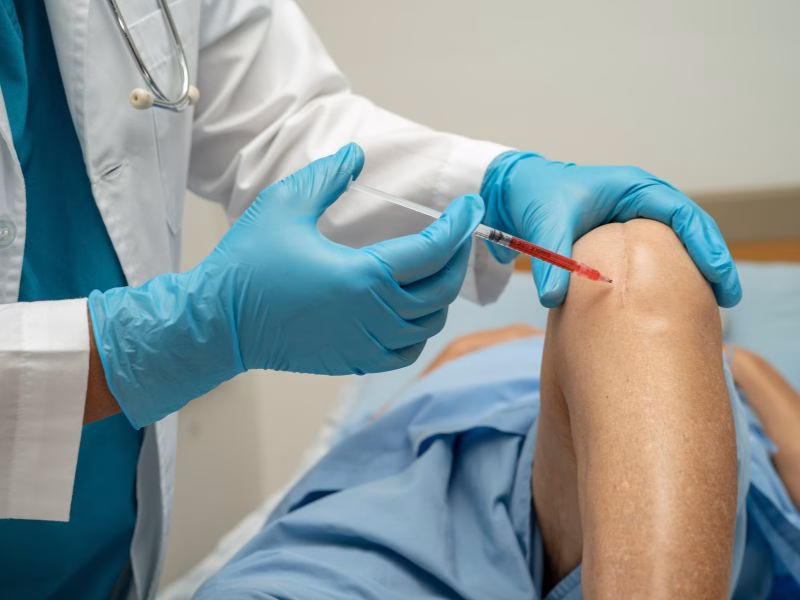 Tratamiento con plasma rico en plaquetas